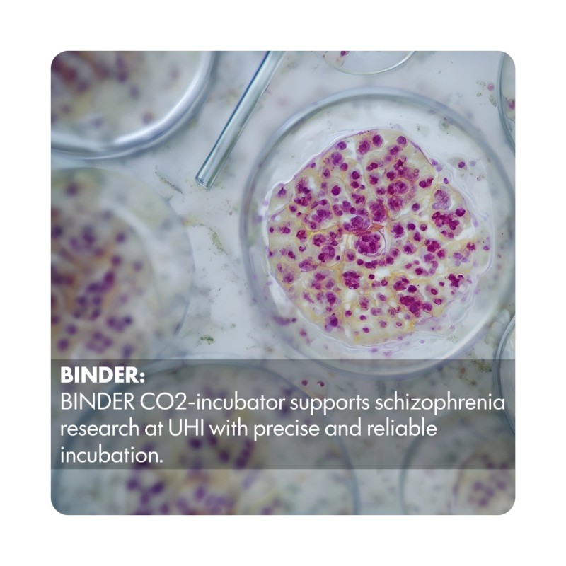 BINDER: CO2-incubator supports schizophrenia research at UHI with precise and reliable incubation.